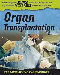 Organ Transplantation